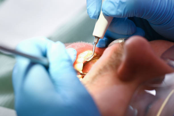 Best Pediatric Emergency Dentist in Columbus, MS