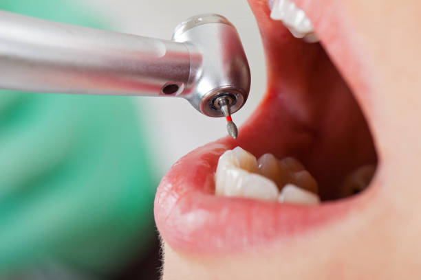 Best Emergency Dental Services for Seniors in Columbus, MS